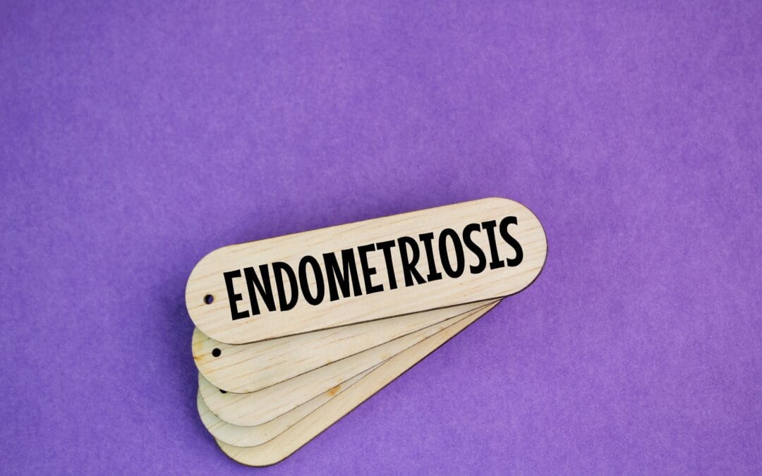 Exploring the Benefits of PEMF Therapy for Managing Endometriosis symptoms